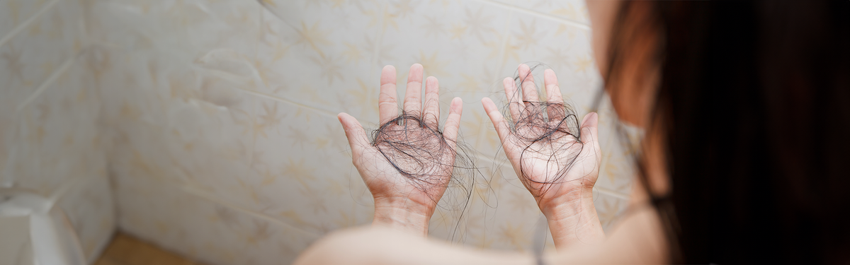 Alles over haaruitval bij vrouwen, oorzaken en wat je eraan kan doen