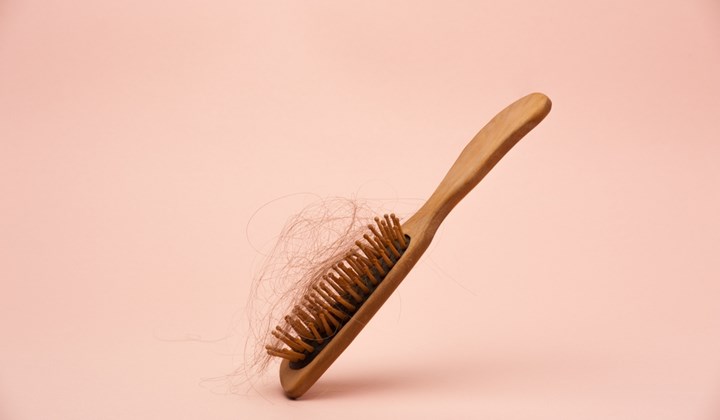 Perte de cheveux table des matières Perte de cheveux table des matières