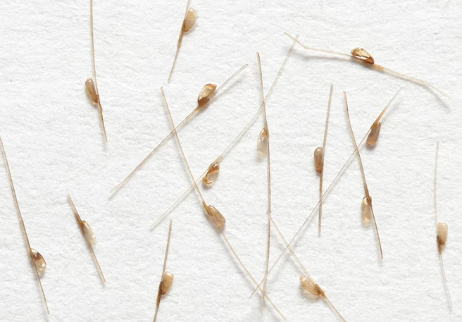 Vous ignorez comment reconnaître les œufs de poux et comment les traiter ? On vous explique tout !