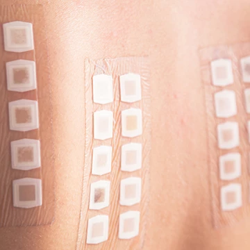 Un médecin peut découvrir pour quelle substance vous êtes allergique via des marqueurs collés sur la peau.