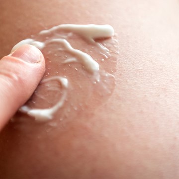 Le traitement d'une réaction cutanée allergique est généralement symptomatique.