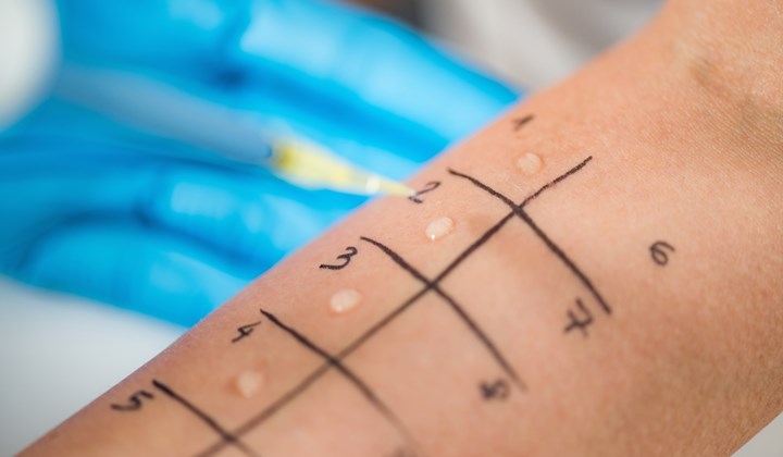 Le contact de la peau avec une substance à laquelle vous êtes allergique peut également provoquer de l'eczéma.