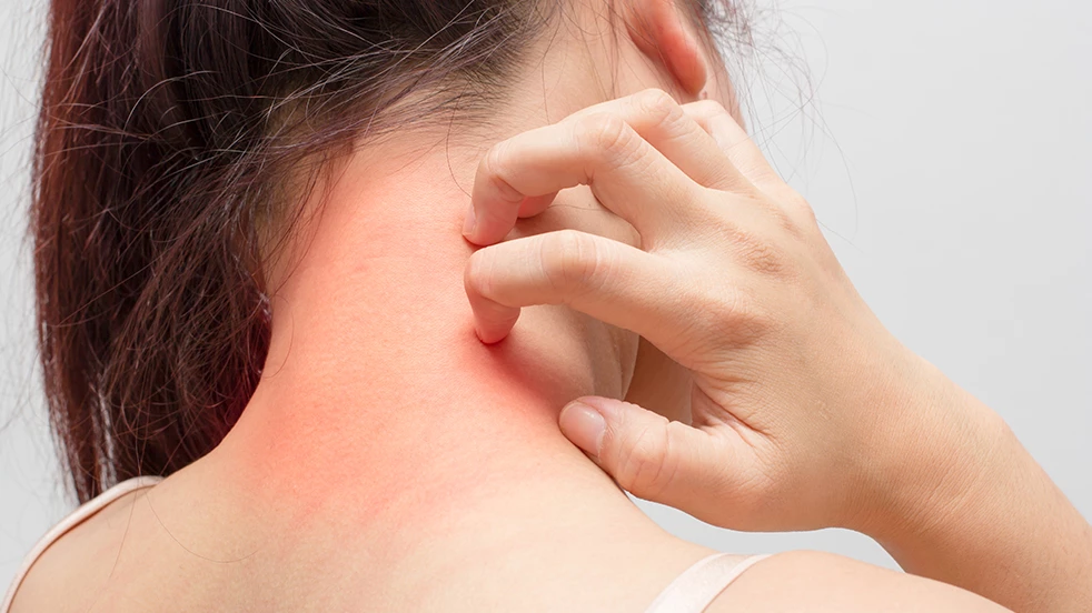 Vous pouvez lire ici comment prévenir ou réduire l'eczéma.