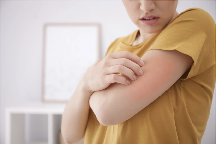 Lisez ici quelles sont les causes de l'eczéma atopique.
