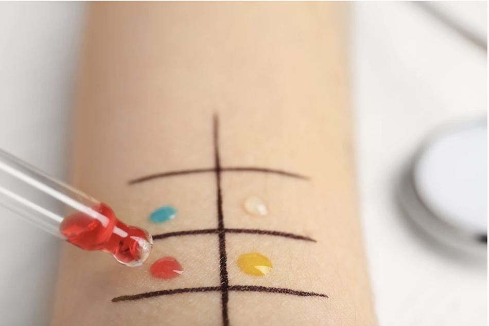 L'eczéma atopique est mieux traité par un médecin.